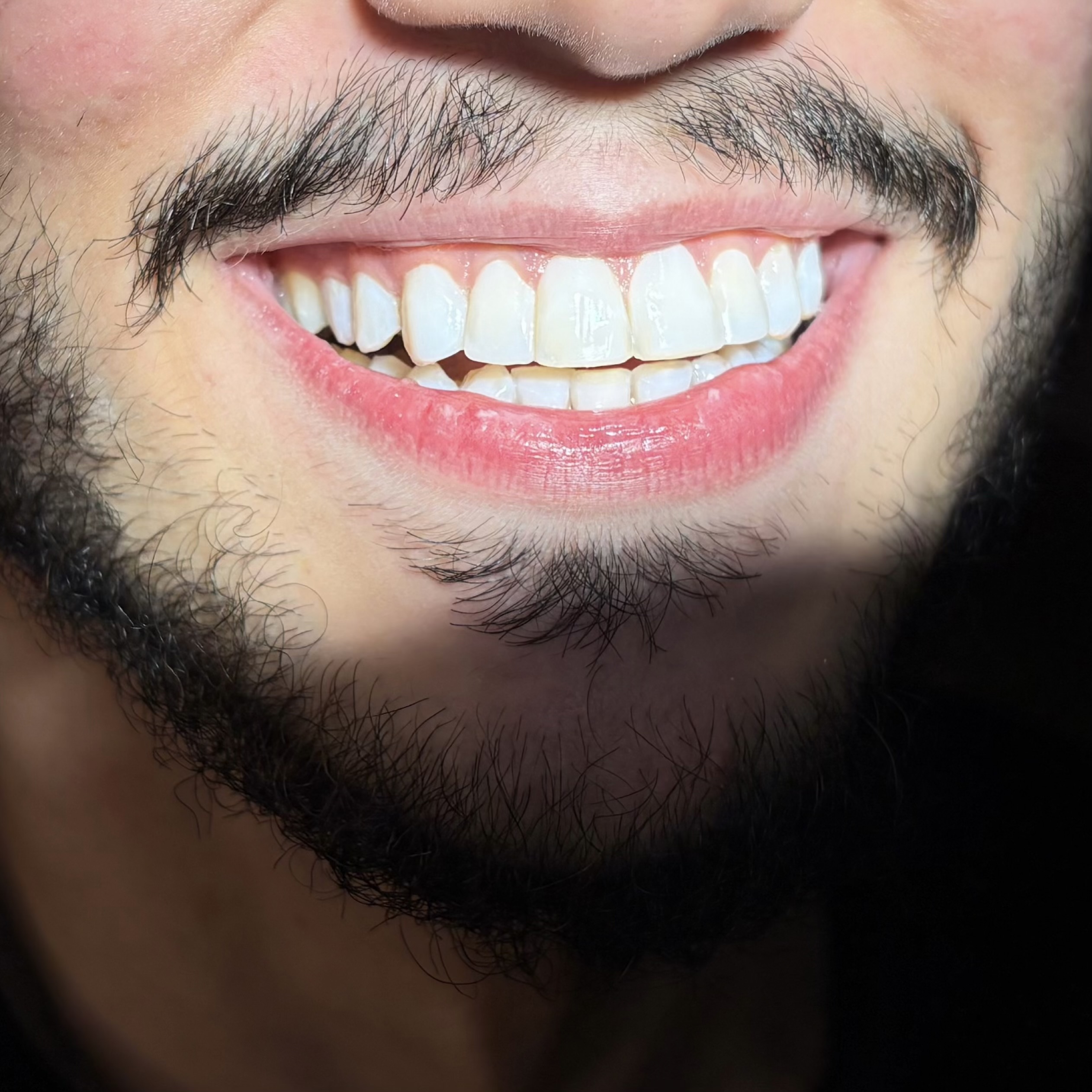 الرئيسية After