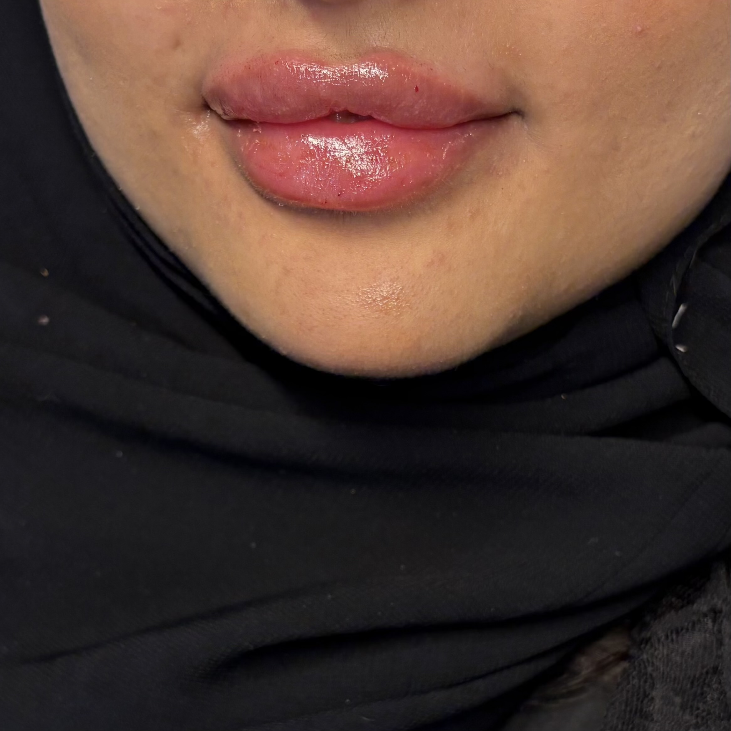 الرئيسية After