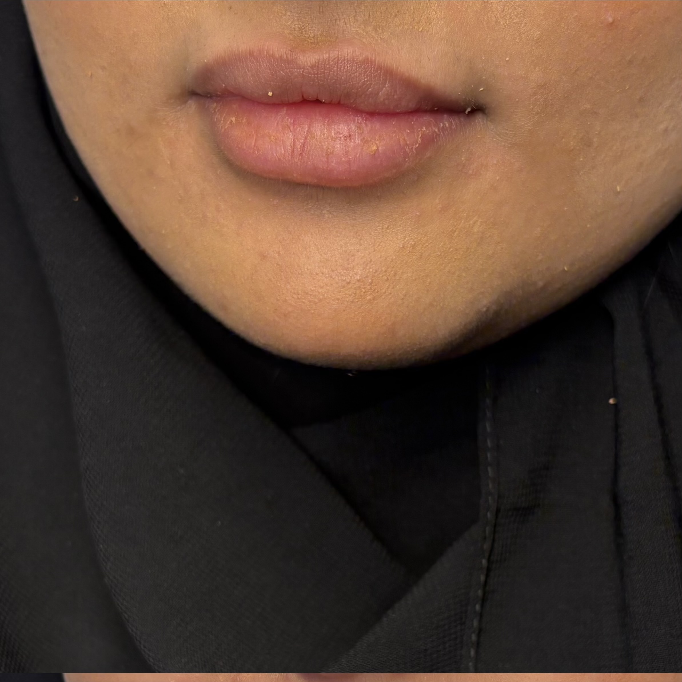 الرئيسية Before